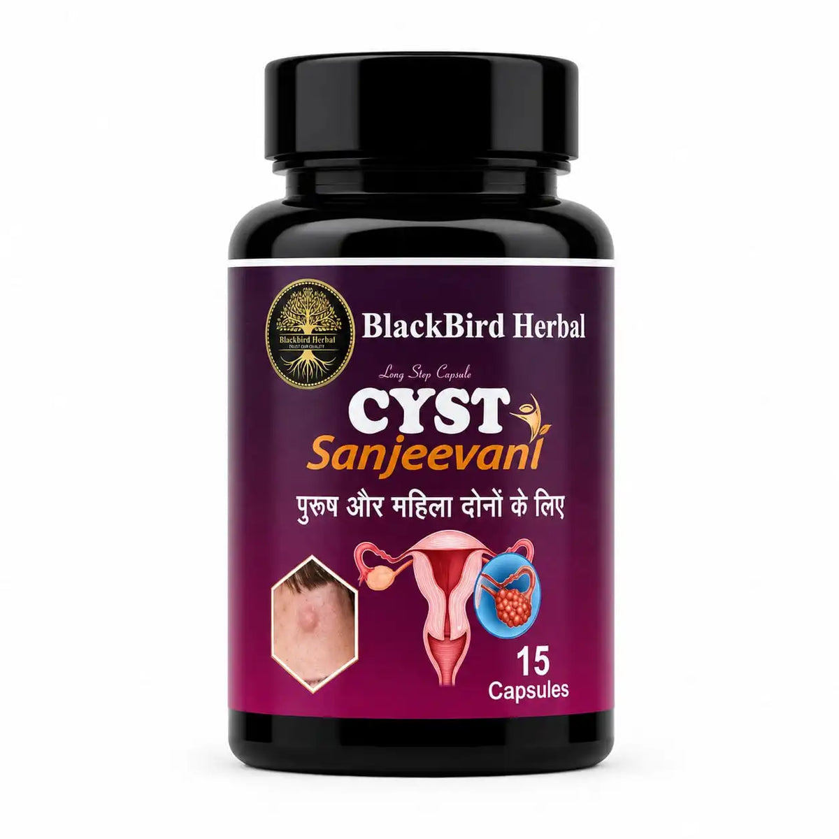 BlackBird Herbal CYST Sanjeevani – Ayurvedic PCOS & Hormonal Wellness Capsules